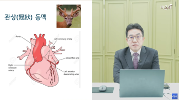 [유튜브 비온뒤] 관상동맥질환 바로 알기 - [인천 심장(심혈관·대동맥) 명의] 가톨릭관동대학교 국제성모병원 심장혈관흉부외과 류상완 교수