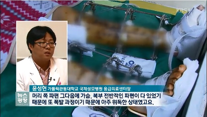 KBS 뉴스광장 - 응급의학과 윤성현 교수
