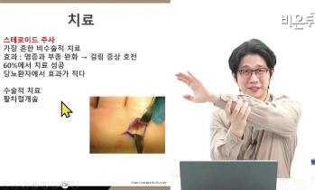 [비온뒤] 일상 속 관절 질환 통증 - 정형외과 김상희 교수