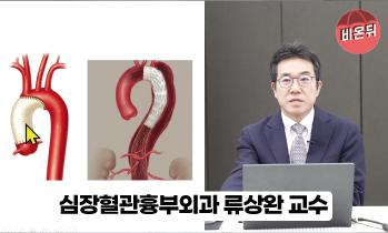 [유튜브 비온뒤] 대동맥질환 - [인천 심장(심혈관·대동맥) 명의] 가톨릭관동대학교 국제성모병원 심장혈관흉부외과 류상완 교수