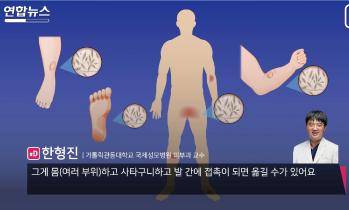 장마철 실내 곰팡이 주의보…건강 지키려면 - 한형진 교수