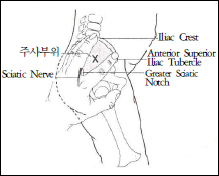 Ventral gluteal muscle의 주사부위