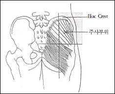 Dorso-gluteal 부위