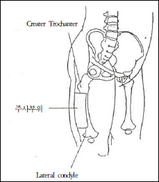 대퇴 Vastus lateralis muscle의 주사부위